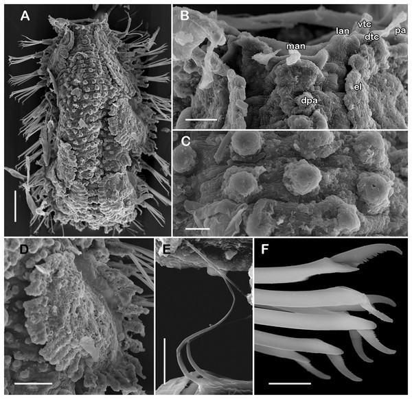 SEM micrographs of paratype of Taylorpholoe anabelae sp. nov. (ECOSUR 297).