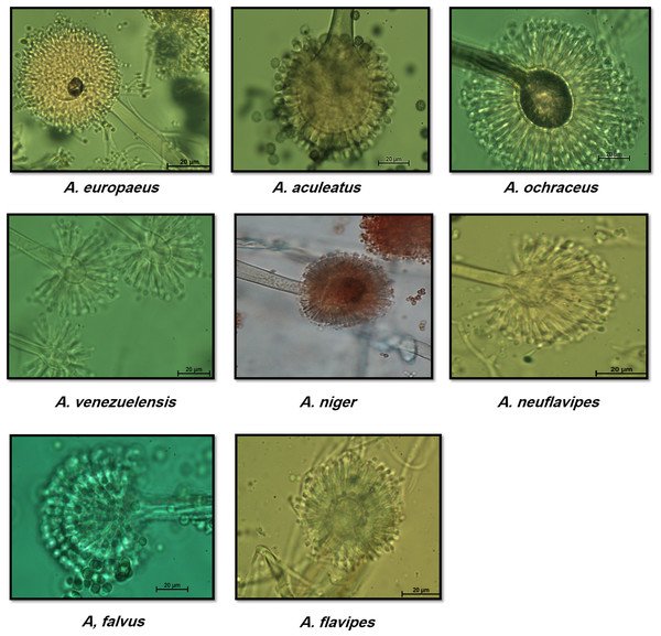 Morphological characteristics of of Aspergillus species isolated from soil invertebrates in Taif, Saudi Arabia on Czapek Agar (CZA) medium after 6 days at 25 ± 2 °C.