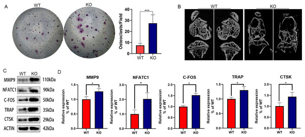 The effect of CYP27A1 knockout (KO) on the osteoclast differentiation, bone loss and gene expression.