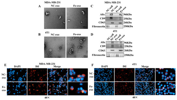 Macrophages internalize breast cancer cell-derived exosomes induced by ferroptosis.