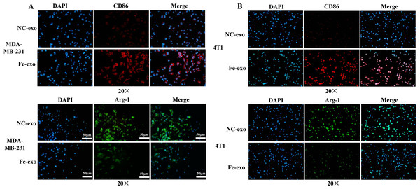 Effects of ferroptosis-induced breast cancer cell-derived exosomes on expression of M1 and M2 macrophage markers.