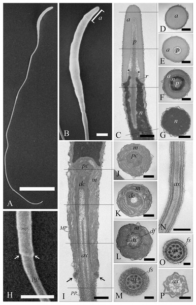 Electron microscopy characterization of the spermatozoon of A. gentilis.