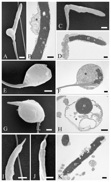 Electron microscopy images of sperm head defects.
