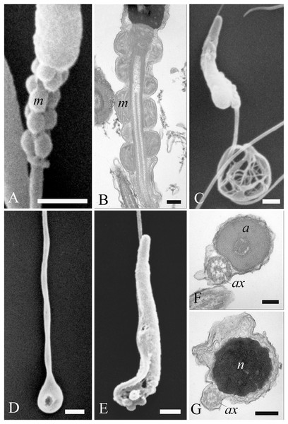 Electron microscopy images of sperm tail defects.
