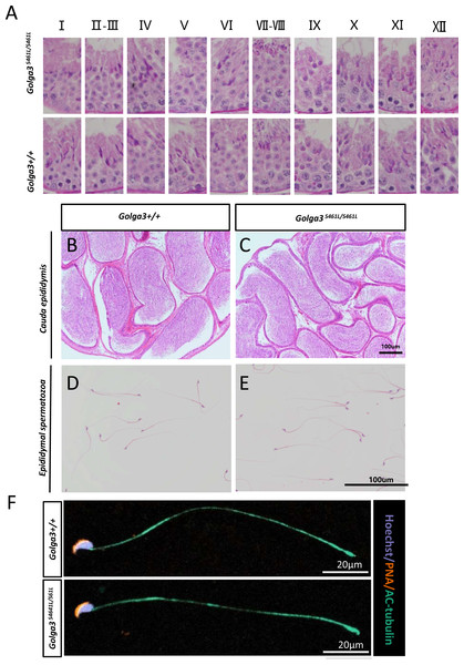 Normal spermatogenesis in Golga3S461L/S461L mice.