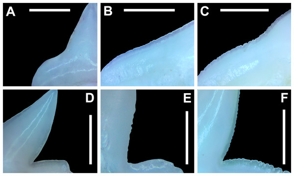 Morphology of the mesial and distal cutting edges on Rhizoprionodon terraenovae teeth.