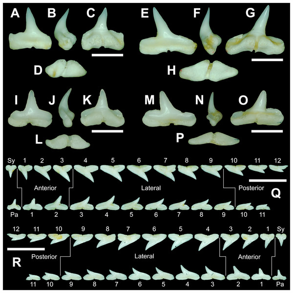 Dentition of a mature male Rhizoprionodon terraenovae and a comparison of gynandric (male) and non-gynandric (female) tooth morphologies.