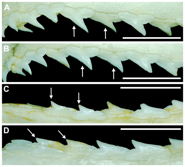 Gynandric heterodonty in mature male vs female Rhizoprionodon terraenovae.