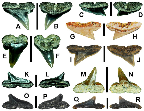 Paleogene †R hizoprionodon ganntourensis teeth from Alabama, USA.