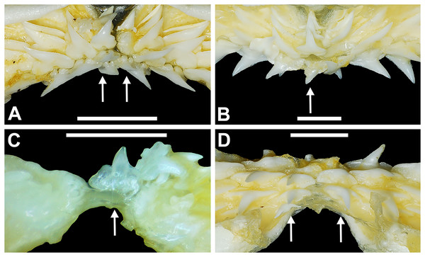 Variation in the number of parasymphyseal and symphyseal files in Rhizoprionodon terraenovae.