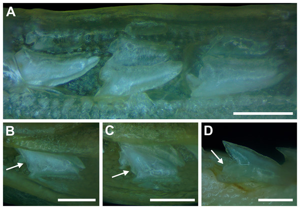 Development of Rhizoprionodon terraenovae tooth rows, files, and distal heel.