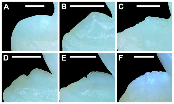 Distal heel morphologies on Rhizoprionodon terraenovae teeth.
