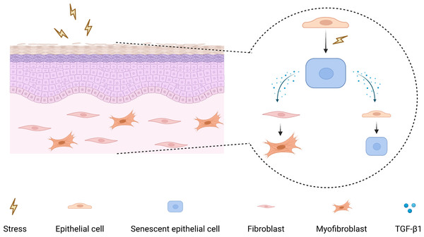 The mechanism diagram for the role of senescent epithelial cells in the development of OSF.