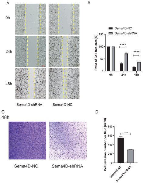 Sema4D deficiency potentiates nivolumab inhibitory effects on B16-F10R cell invasion and migration.