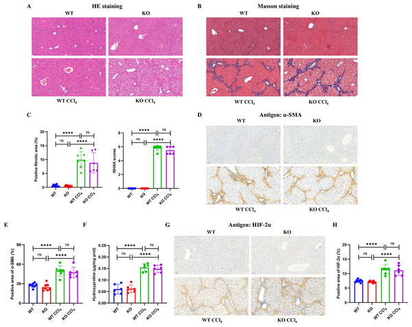 Hepatocyte-specific HIF-2α deficiency does not improve fibrogenesis in liver fibrosis mice.
