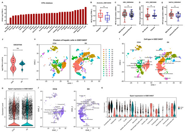 HIF-2α expression in the liver based on bioinformatics analyses.