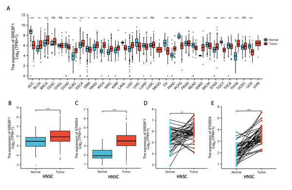 SREBF1 expression in human pan-cancers.