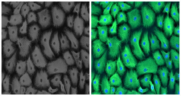 Positive immunofluorescence for epithelial cell marker Cytokeratin 18 on GMECs.
