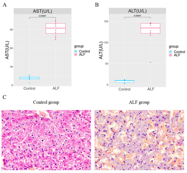 Establishment of the ALF mouse model.