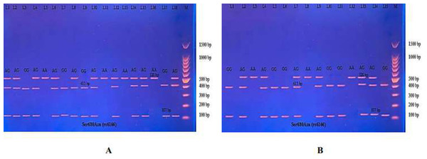 (A–B) Electrophoretogram of DNA fragments for Ser680Asn polymorphisms after digestion with BsrI restriction enzymes.