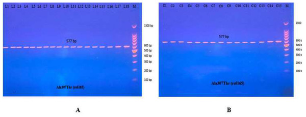 PCR product of FSHR gene (Ala307Thr, 577 bp).