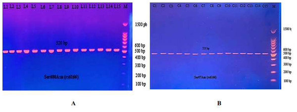 The PCR product of Ser680Asn polymorphism gene on exon 10 of FSHR was 520 bp.