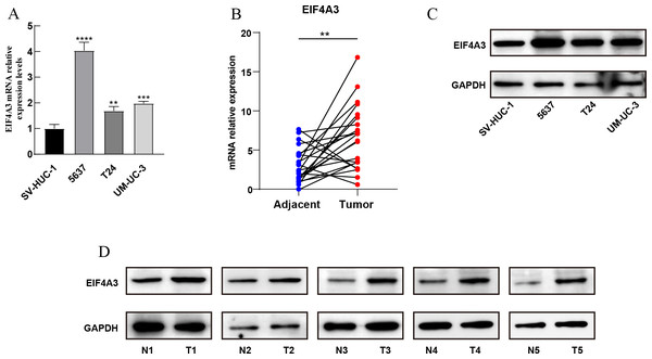 Validation of EIF4A3 expression in cancer cell lines and tissue samples.