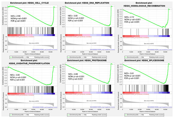 Single-gene gene set enrichment analysis (GSEA) of low SPARCL1 expression in BC.