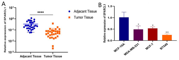 SPARCL1 expression in tissues and cell lines detected by RT-qPCR.