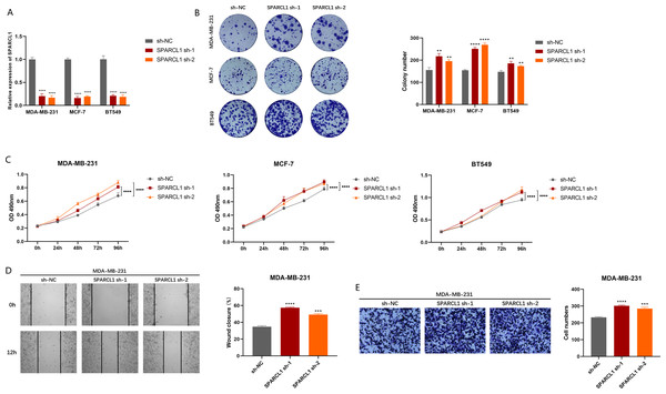 Biological function experiments in BC cells upon SPARCL1 knockdown.