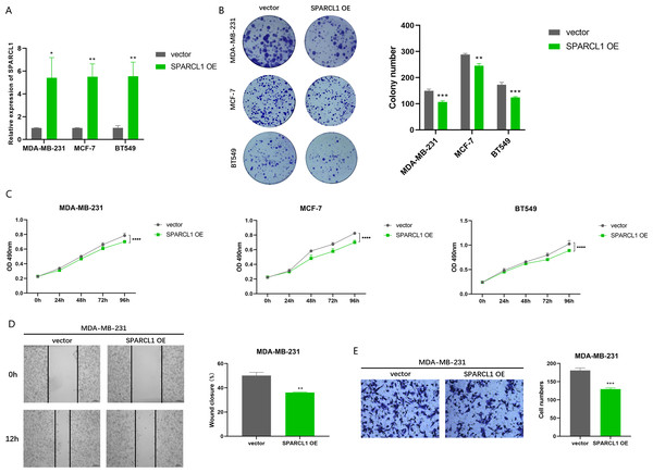 Biological function experiments in BC cells upon SPARCL1 overexpression.