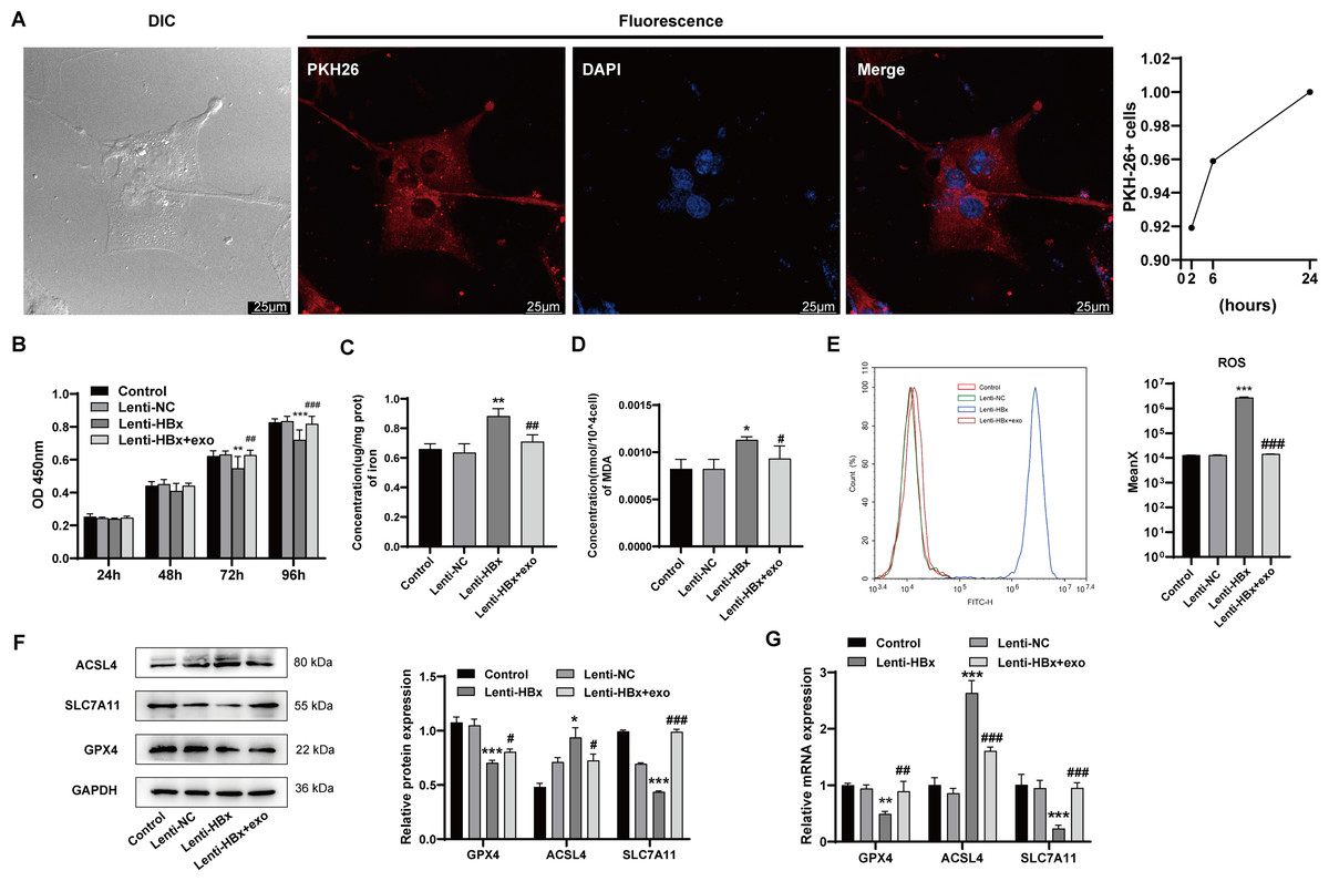 Bone Marrow Mesenchymal Stem Cell-derived Exosomes Protect Podocytes ...