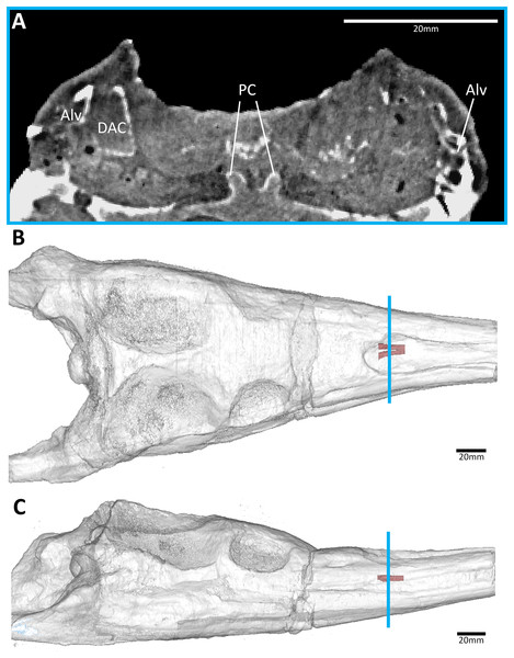 The early-diverging teleosauroid Plagiophthalmosuchus gracilirostris (NHMUK PV OR 15500), from the early Toarcian of the UK.