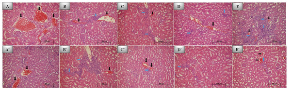 7th and 30th day histological images of kidney tissue for all groups.