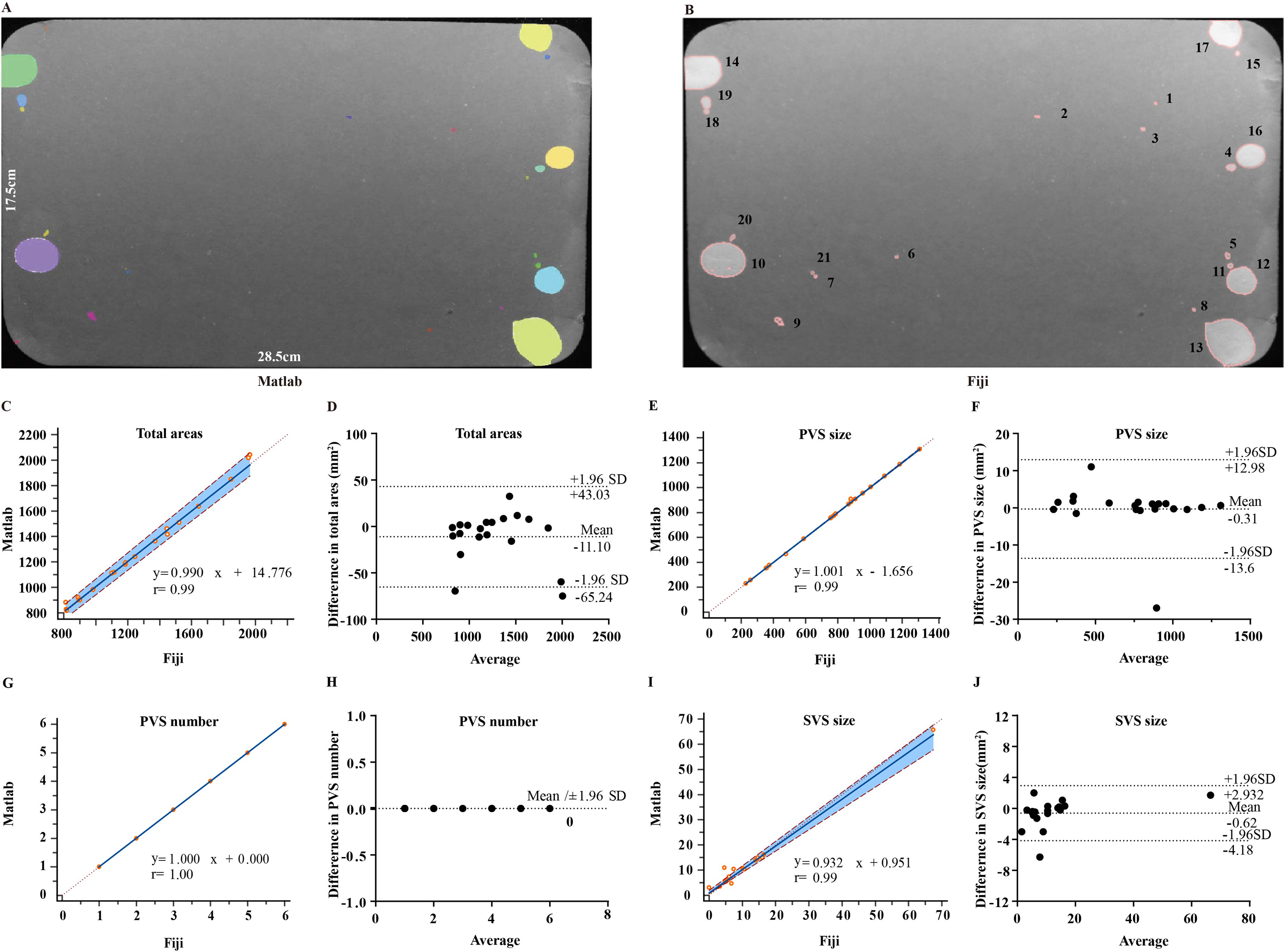 NMDAR in bladder smooth muscle is not a pharmacotherapy target for  overactive bladder in mice [PeerJ]