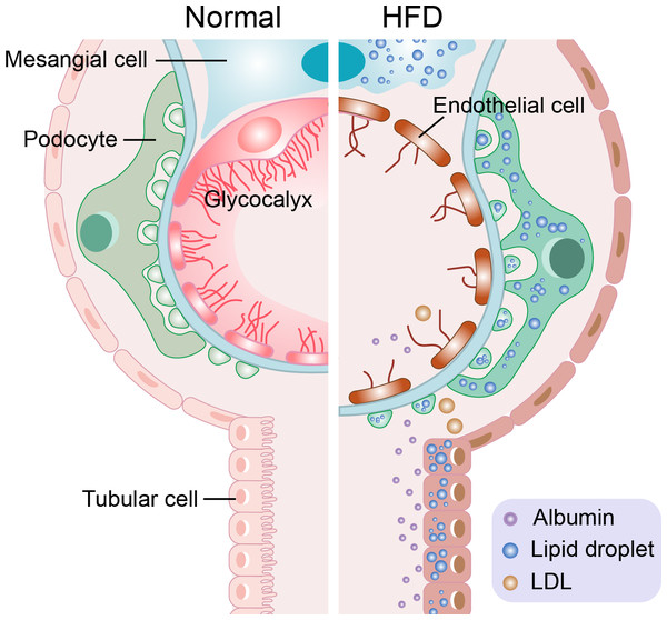 The role of exercise in improving hyperlipidemia-renal injuries induced ...