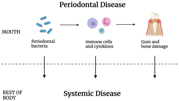 Periodontal disease caused by oral bacteria and oral tissue inflammation contribute to systemic disease but by intermediaries that are not known.