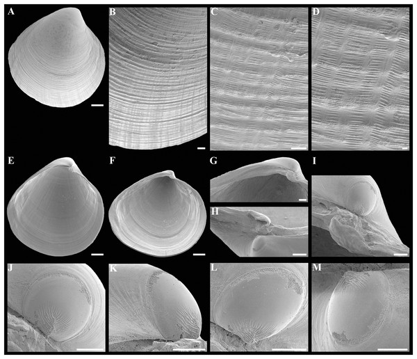 Scanning electron micrographs of the holotype of Axinulus cristatus sp. nov. (MIMB 45892).