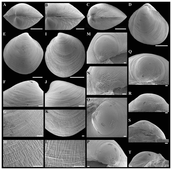 Scanning electron micrographs of Axinulus krylovae sp. nov.