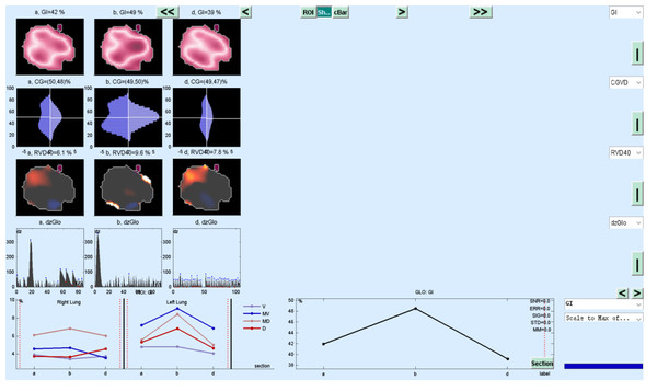 EIT image reconstruction with MATLAB.