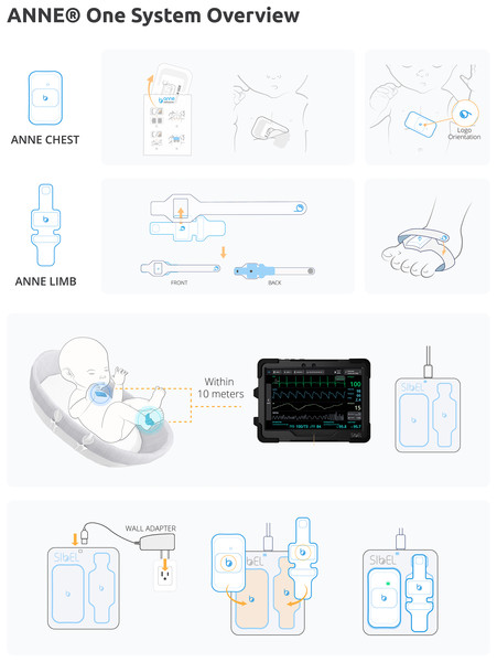 ANNE® one wireless monitoring system.