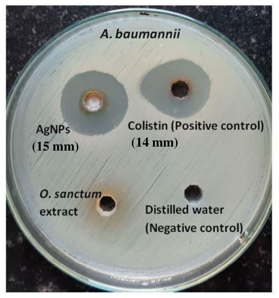 Agar well diffusion test of AgNPs, colistin (positive control) and Ocimum sanctum leaves extract against A. baumannii.