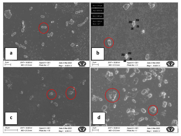 SEM micrograph of A baumannii before and after treatment with AgNPs; (A, B) clear, smooth cells before treatment (inside red circle); (C, D) damaged, ruptured cells after treatment (inside red circle).