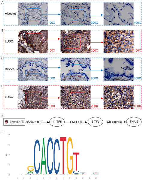 Protein expression and potential molecular mechanisms of MMP12 in LUSC.