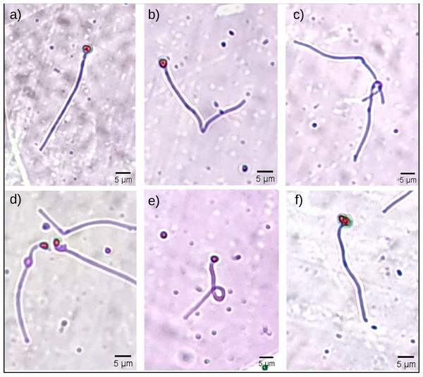 Some morphological abnormalities of Pogonias courbina sperm.