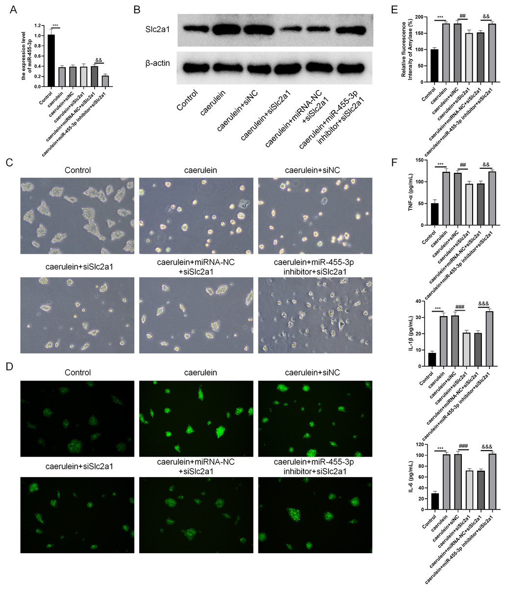 MiR-455-3p Ameliorates Pancreatic Acinar Cell Injury By Targeting ...