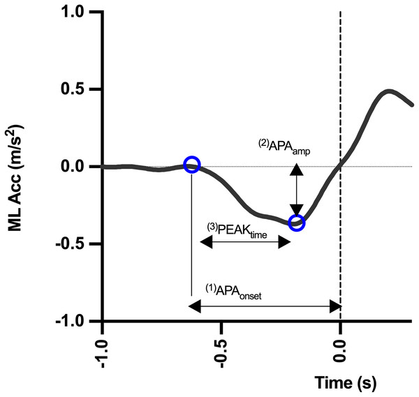 Mid-lateral acceleration curve and measurement variables.