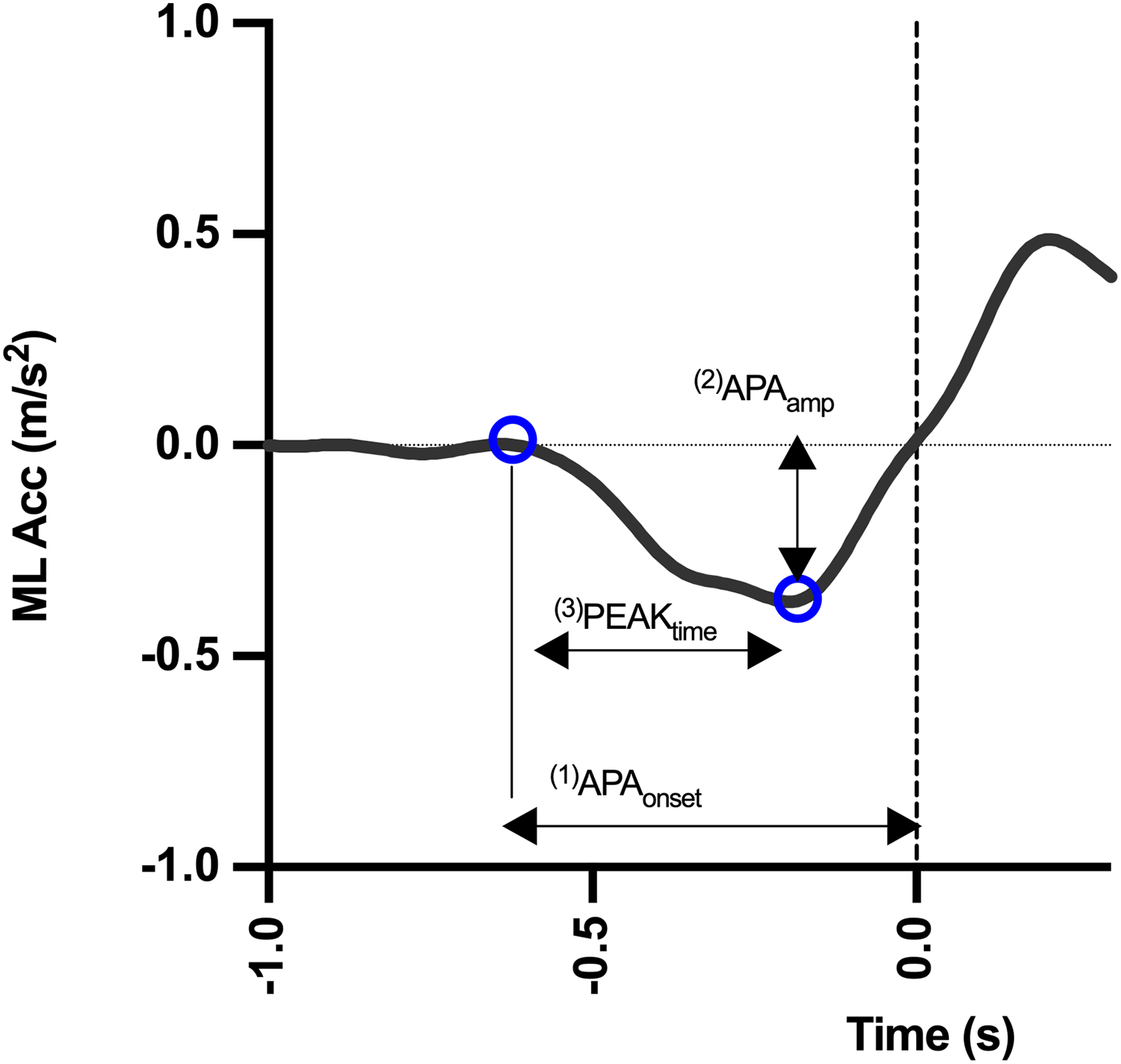 Comparison of inertial records during anticipatory postural