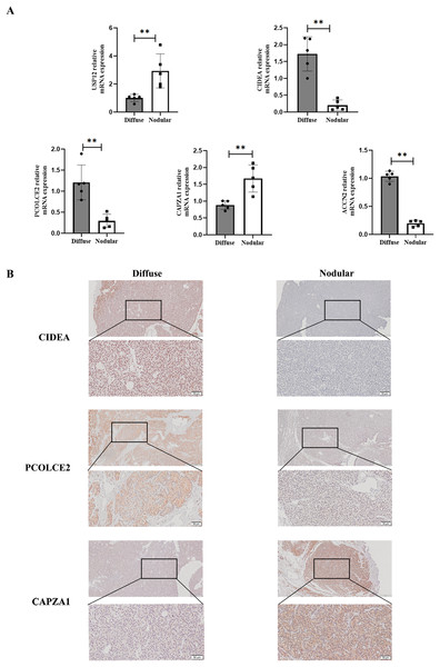 Validation of key gene in parathyroid tissues from SHPT patients.