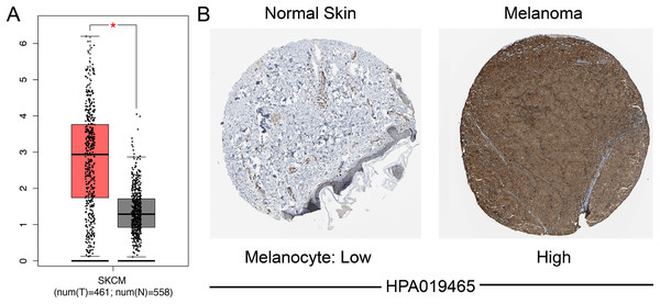 Differential SAMD9L expression in SKCM tissues and adjacent normal tissues.